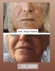 Dott. Diego Dedola_collagene