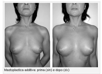 Additiva prima e dopo