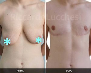 Cambio di sesso - Dott. Riccardo Lucchesi