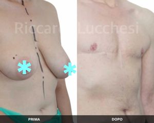 Cambio di sesso - Dott. Riccardo Lucchesi