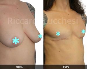 Cambio di sesso - Dott. Riccardo Lucchesi