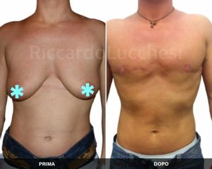Cambio di sesso - Dott. Riccardo Lucchesi
