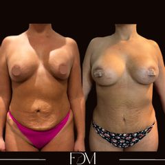 Dott. Filippo Di Meglio
