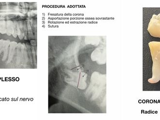 Ortodonzia - 816521