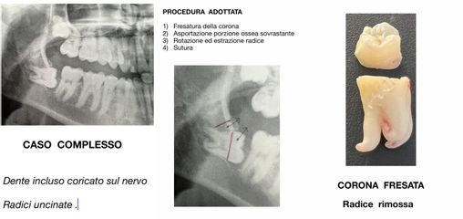 Ortodonzia - Dr. Donaggio Paolo