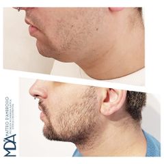 Dott. Matteo D'Ambrosio Lifting Viso