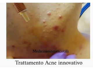 Medicina Estetica Cotilli