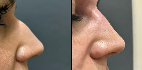 Dott.ssa Cornelia Florea Rinofiller