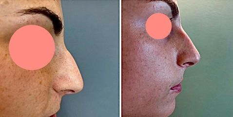 Dott.ssa Cornelia Florea Rinofiller