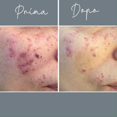 Macchie della pelle - Centro Laser Dermatologico Dott. Laspina