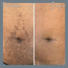 Macchie della pelle - Centro Laser Dermatologico Dott. Laspina