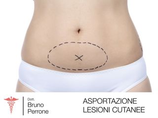 Dott Bruno Perrone