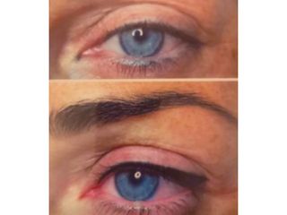 Microblading prima e dopo