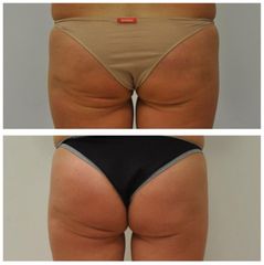 Body Shape - Studio Dermatologico Ricciuti