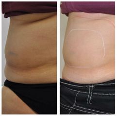 Body Shape - Studio Dermatologico Ricciuti
