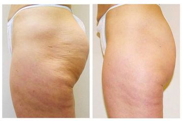 Body Shape - Studio Dermatologico Ricciuti