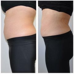 Body Shape - Studio Dermatologico Ricciuti