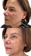 Dott.ssa Sara Carinci Full Face
