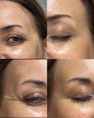 Dott.ssa Sara Carinci Botox