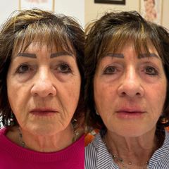 Dott.ssa Sara Carinci Full face viso