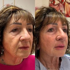 Dott.ssa Sara Carinci Full face viso