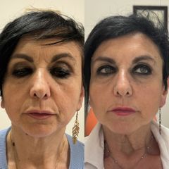 Dott.ssa Sara Carinci Full face viso