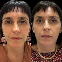 Dott.ssa Sara Carinci Full face viso