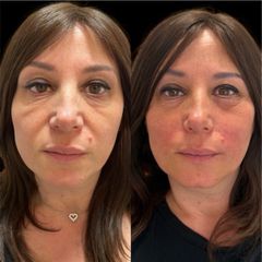 Dott.ssa Sara Carinci Full face viso