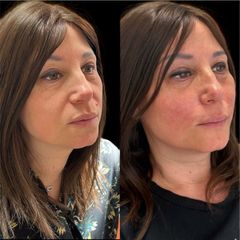Dott.ssa Sara CarinciFull face viso