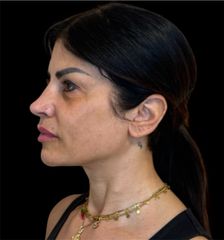 Dott.ssa Sara CarinciFull face viso