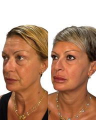 Full face - Dott.ssa Sara Carinci