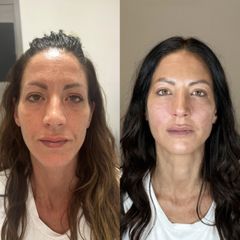 Dott.ssa Sara Carinci Full face