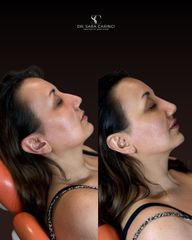 Dott.ssa Sara Carinci Armonizzazione profilo