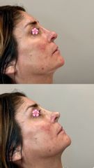 Dott.ssa Sara Carinci Rinofiller