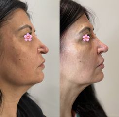 Dott.ssa Sara Carinci Rinofiller