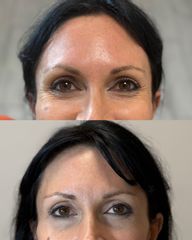 Dott.ssa Sara Carinci Botulino