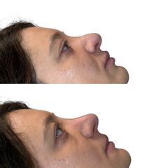 Dott.ssa Sara Carinci Rinofiller