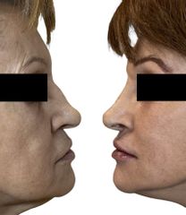 Dott.ssa Sara Carinci Rinofiller