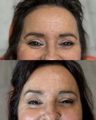 Dott.ssa Sara Carinci Botox