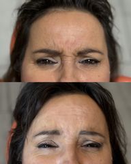 Dott.ssa Sara Carinci Botox