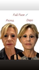 Dott.ssa Sara Carinci Full face