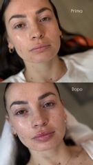 Dott.ssa Sara Carinci Filler labbra