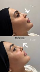 Dott.ssa Sara Carinci Rinofiller