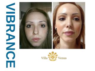 Vibrance - Clinica Villa Venus