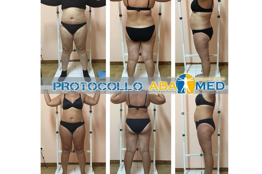 Dieta prima e dopo - 767417