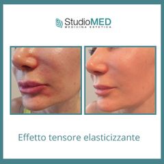 Laserterapia - StudioMed Centro Medicina Estetica