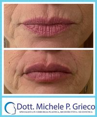 Filler - Dr. Michele P. Grieco, PhD
