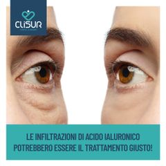 Acido ialuronico - Clisur- Clinical & Surgery