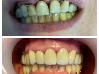 Faccette dentali - 807797