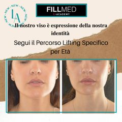 Lifting viso non chirurgico - Dr. Luca M. Apollini